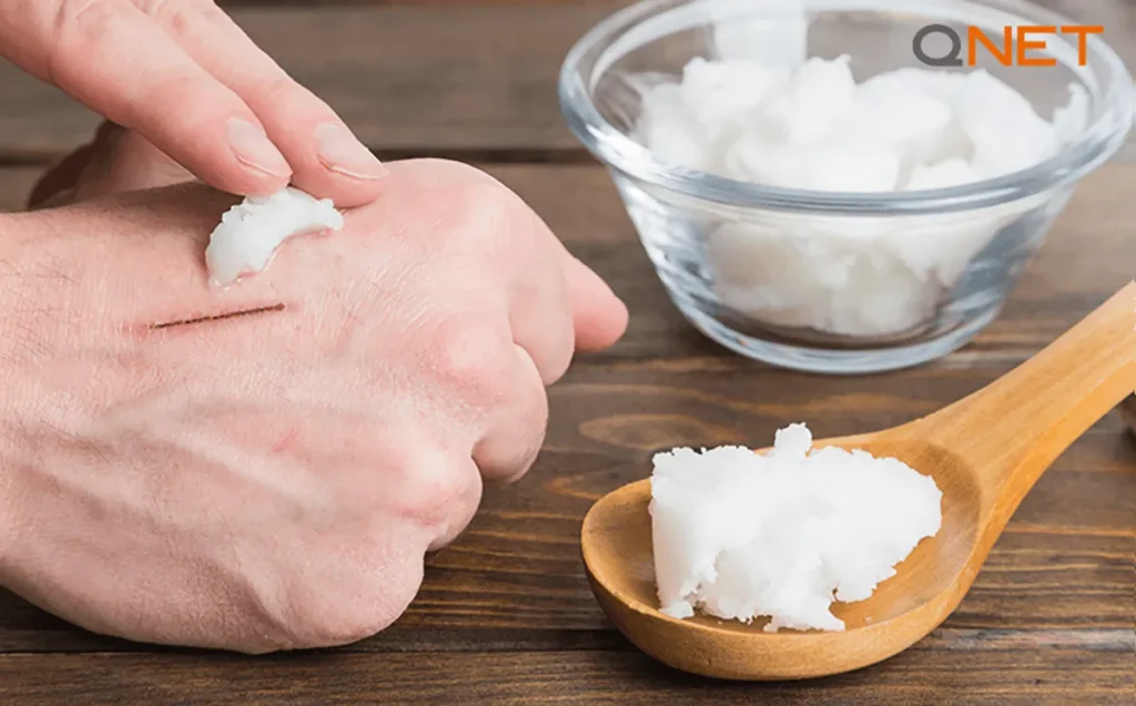 Applying Nutriplus Virgin Coconut Oil to wound